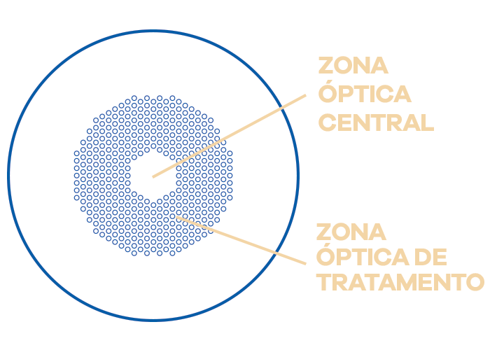 Zona Ótica